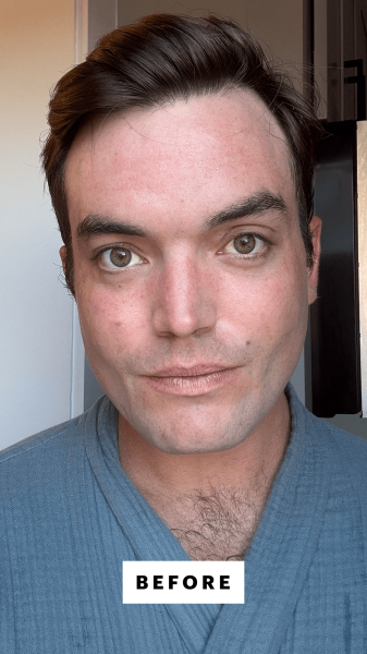 Manso before applying the Chanel Les Beiges WaterFresh Tint